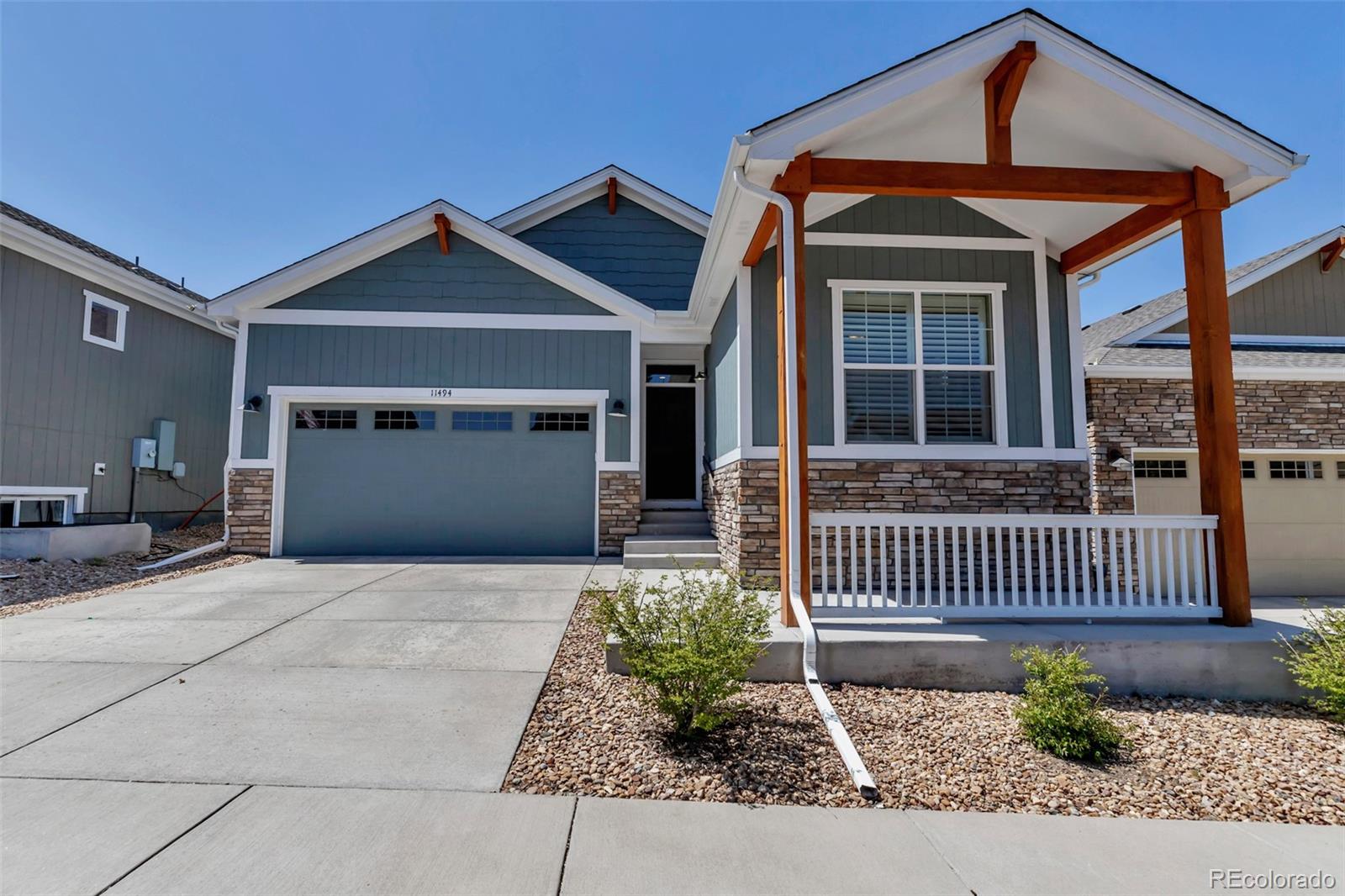 11494  Colony Loop, parker  House Search MLS Picture