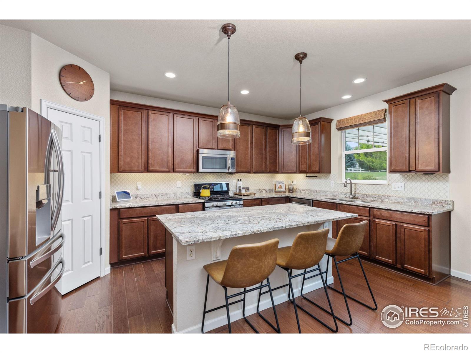 MLS Image #11 for 3215  bryce drive,fort collins, Colorado