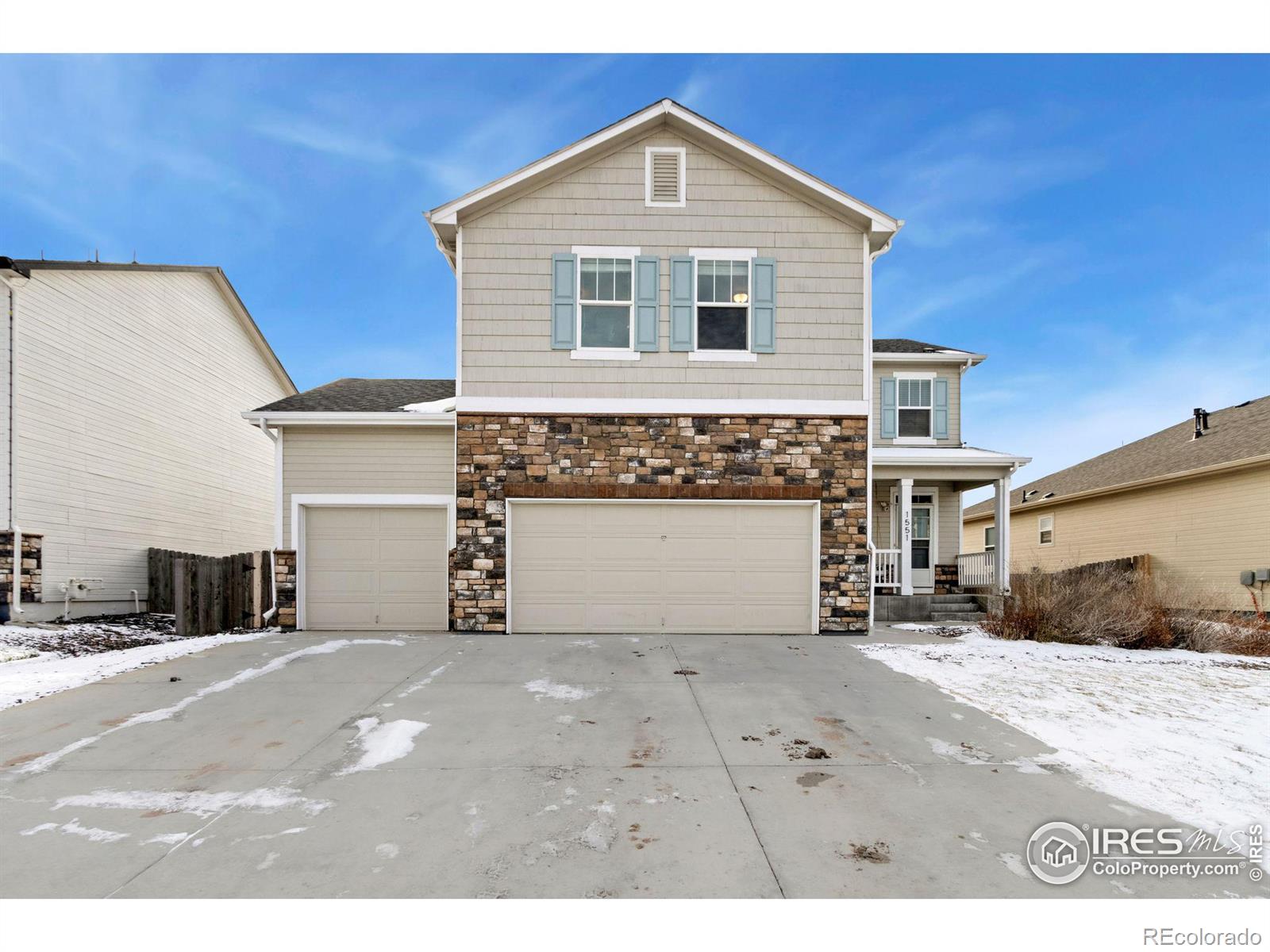 MLS Image #2 for 1551  highfield drive,windsor, Colorado