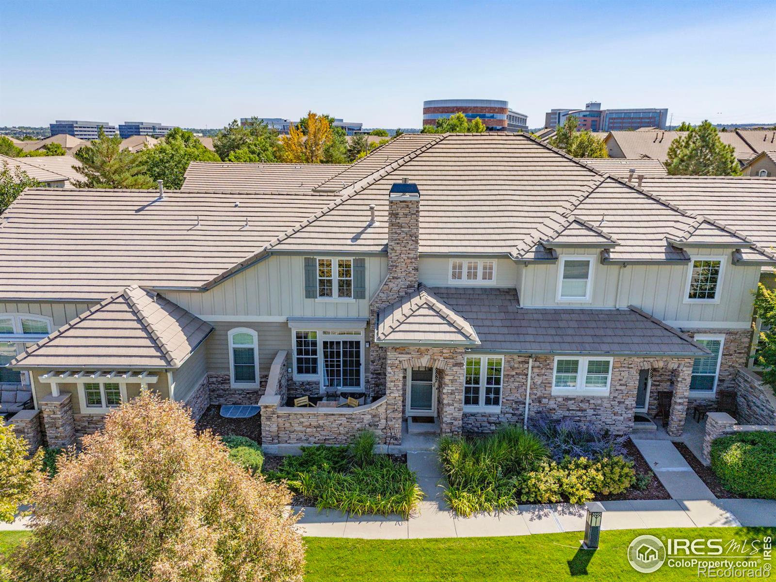 MLS Image #2 for 8887  tappy toorie circle,highlands ranch, Colorado