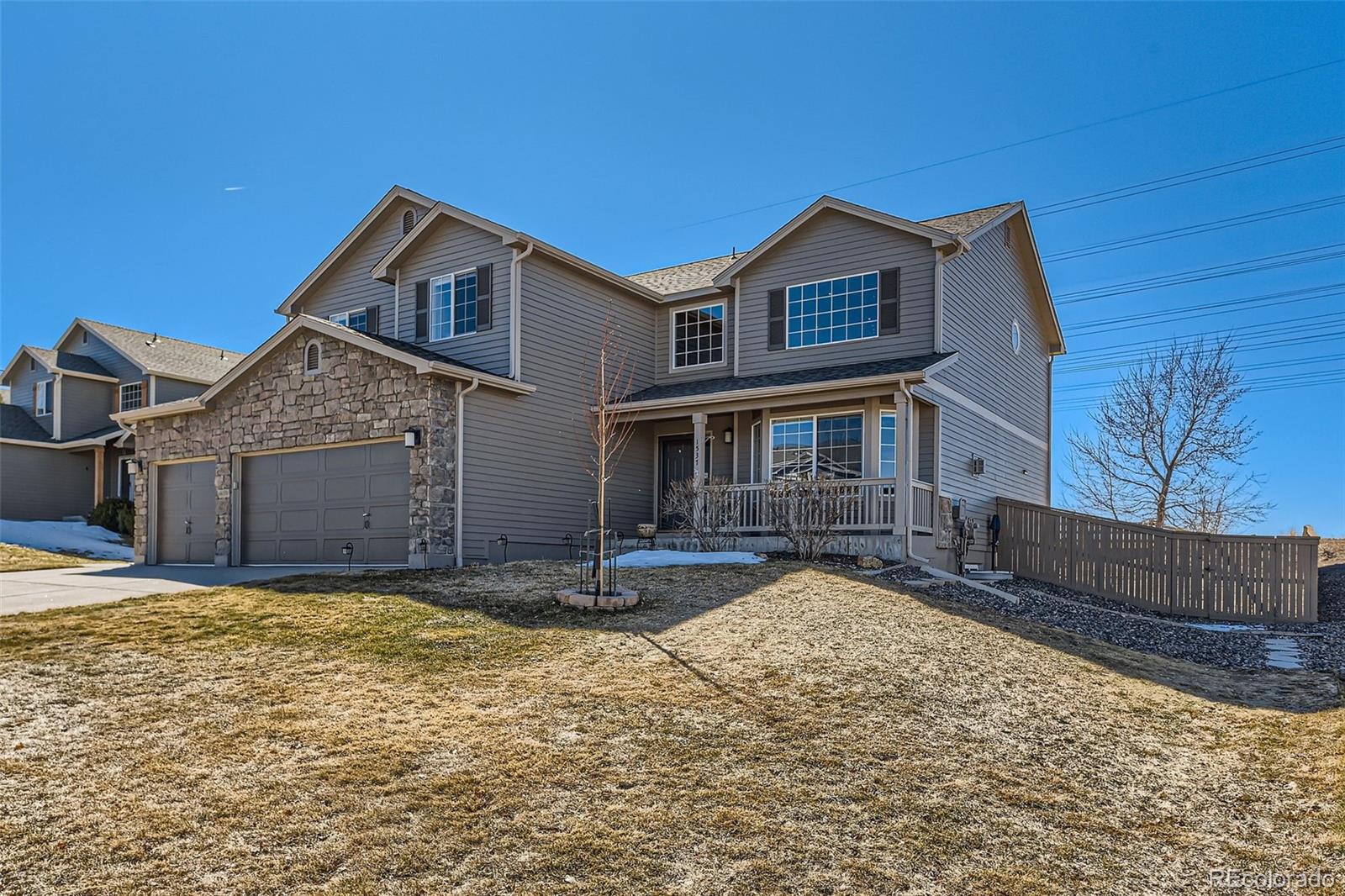 CMA Image for 1537  Rosedale Street,Castle Rock, Colorado