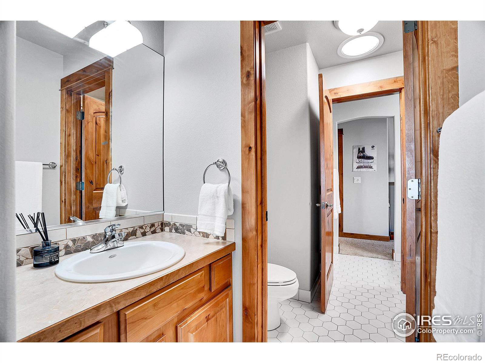 MLS Image #21 for 8276  sand dollar drive,windsor, Colorado