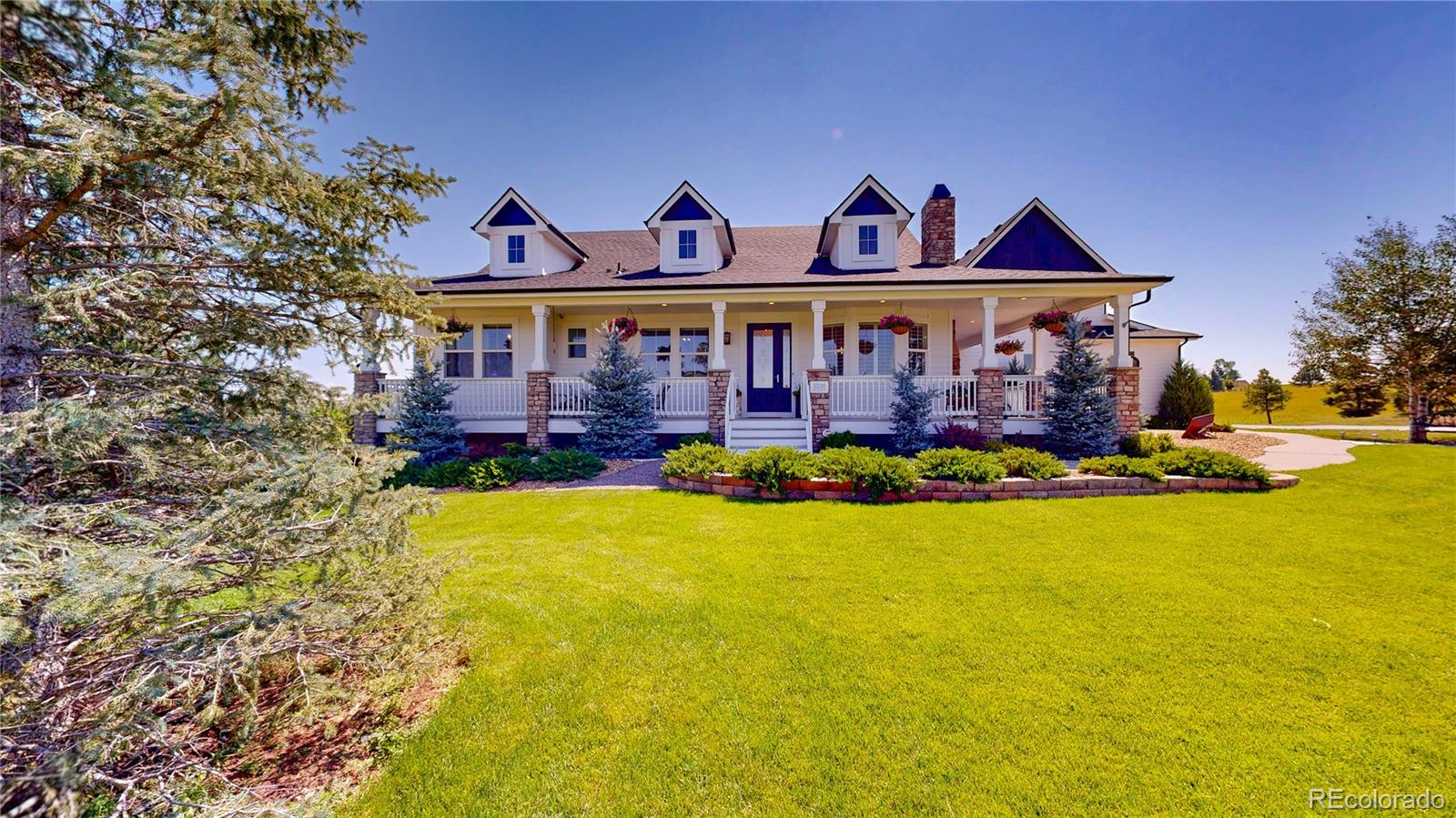 MLS Image #4 for 33530  greystone circle,elizabeth, Colorado