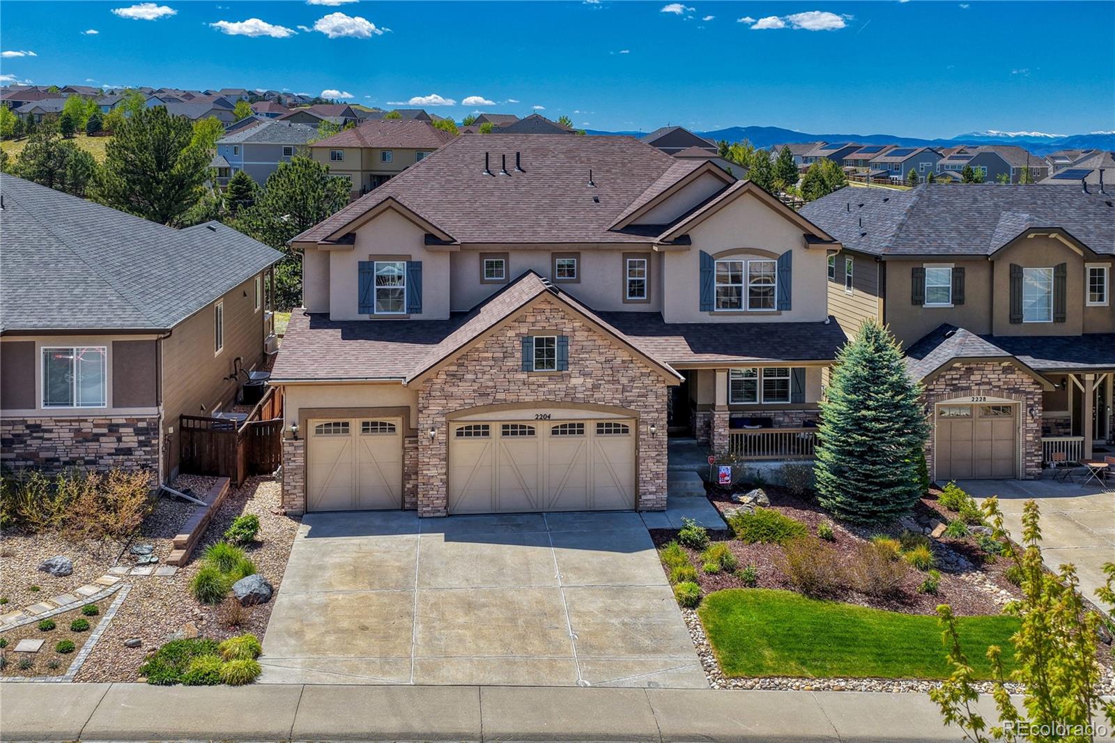 MLS Image #0 for 2204  treetop drive,castle rock, Colorado