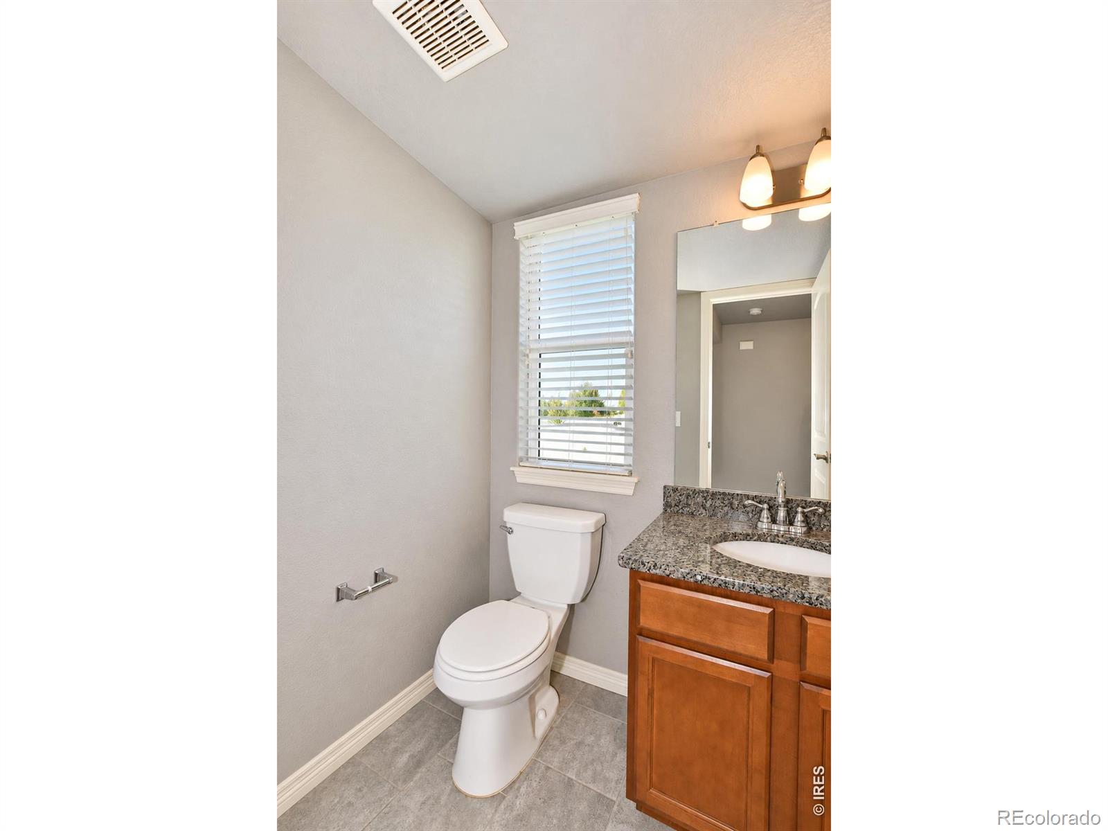 MLS Image #3 for 6001  clarence drive,windsor, Colorado