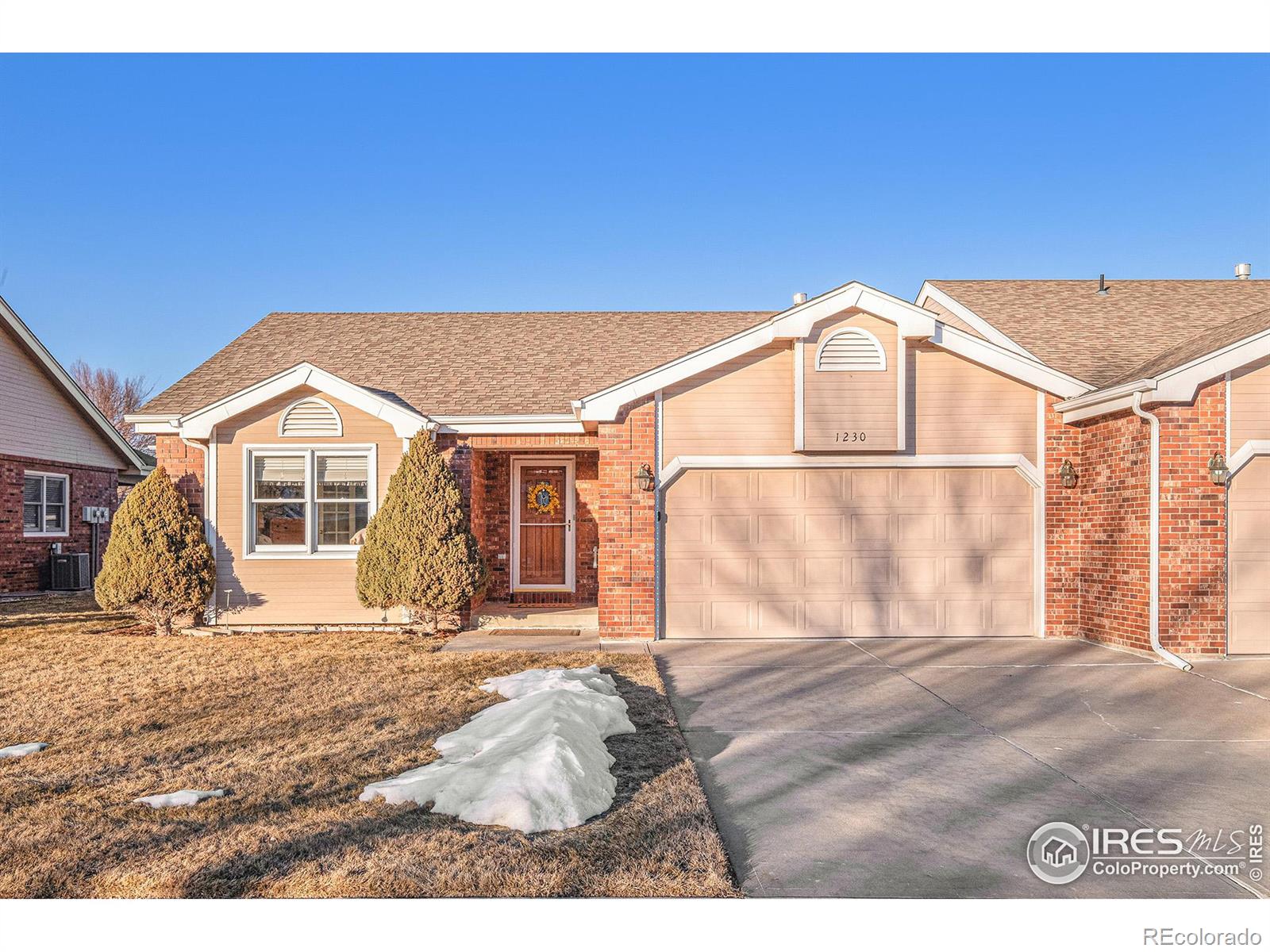 MLS Image #20 for 1230  honeysuckle court,windsor, Colorado