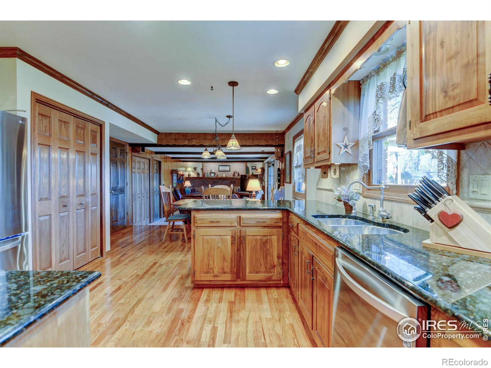 MLS Image #5 for 2706  granada drive,loveland, Colorado