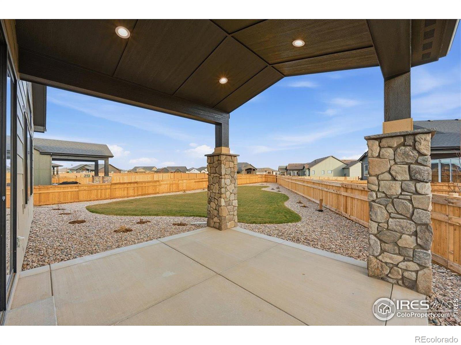 MLS Image #28 for 31  snowcap drive,windsor, Colorado