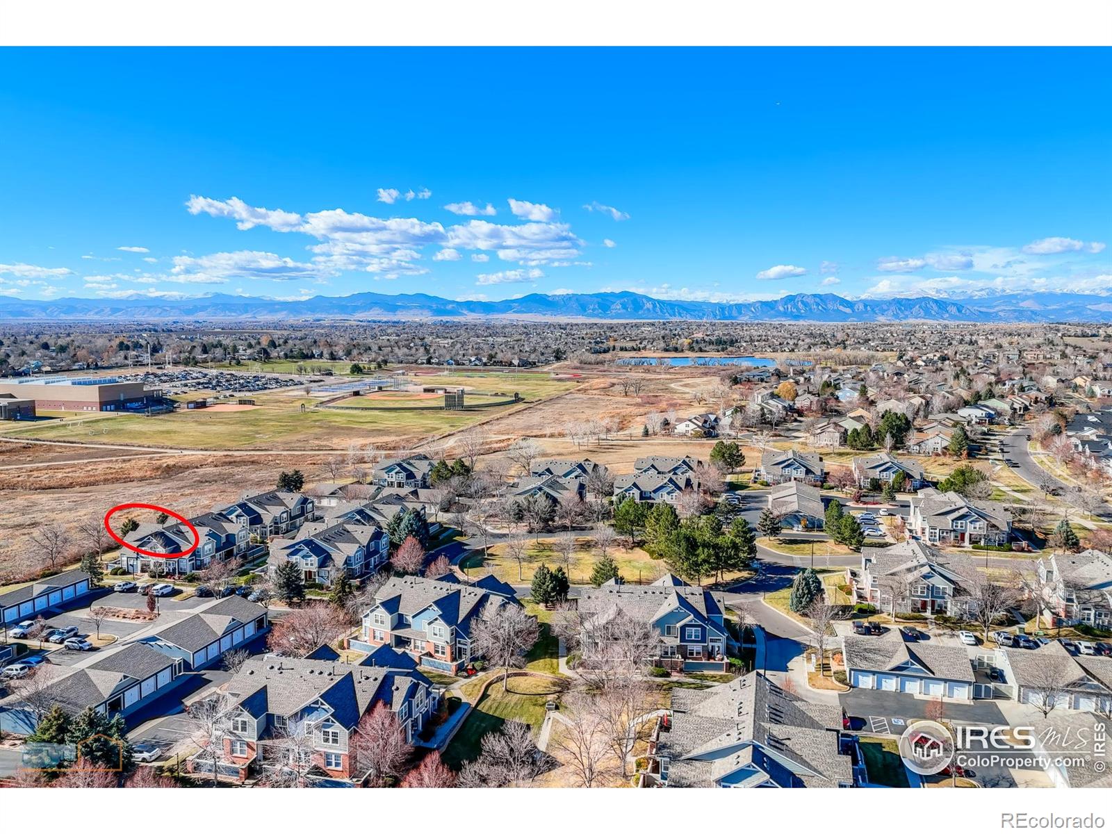 MLS Image #3 for 13900  lake song lane,broomfield, Colorado