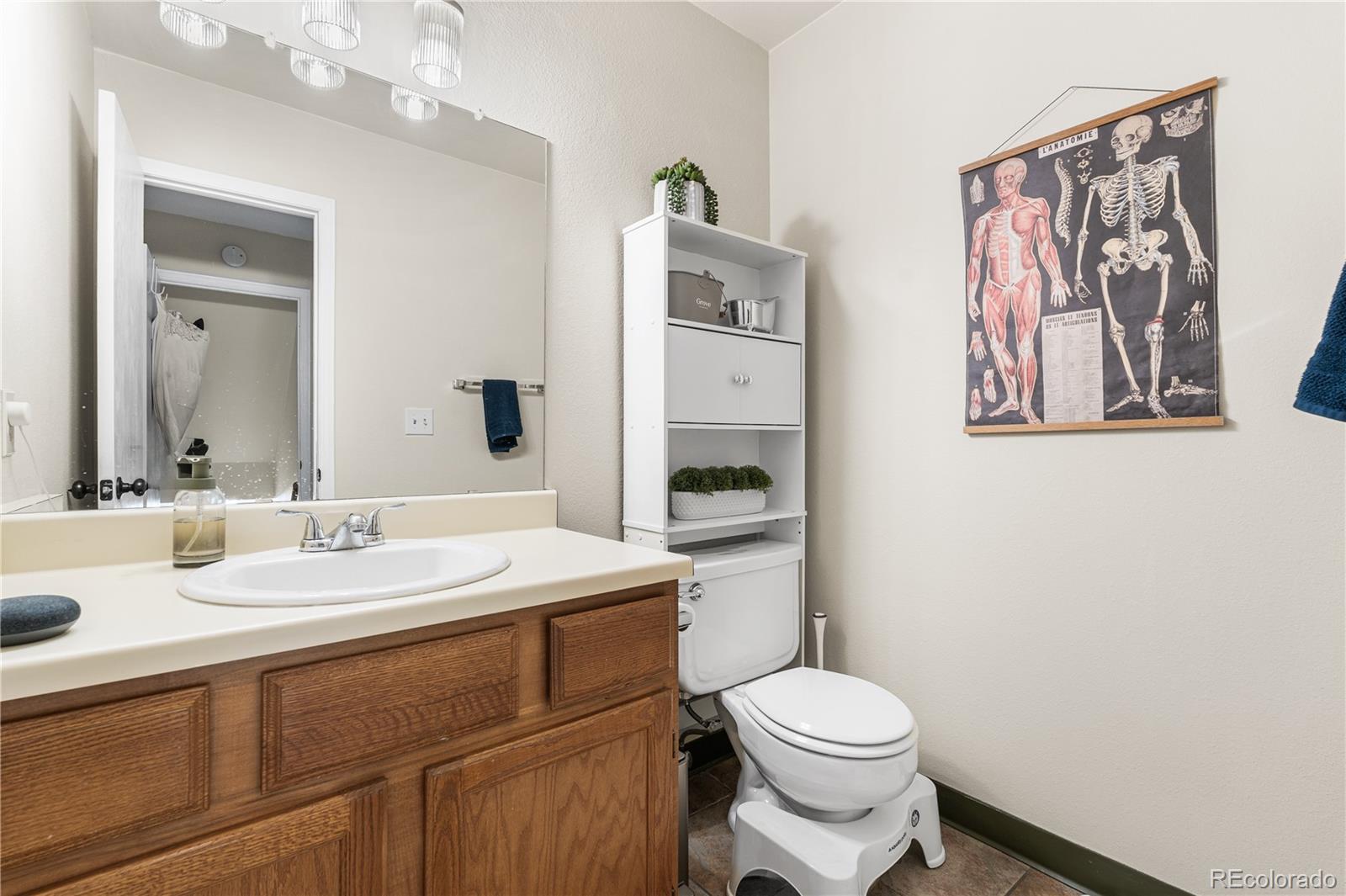 MLS Image #11 for 11153 w 17th avenue 104,lakewood, Colorado