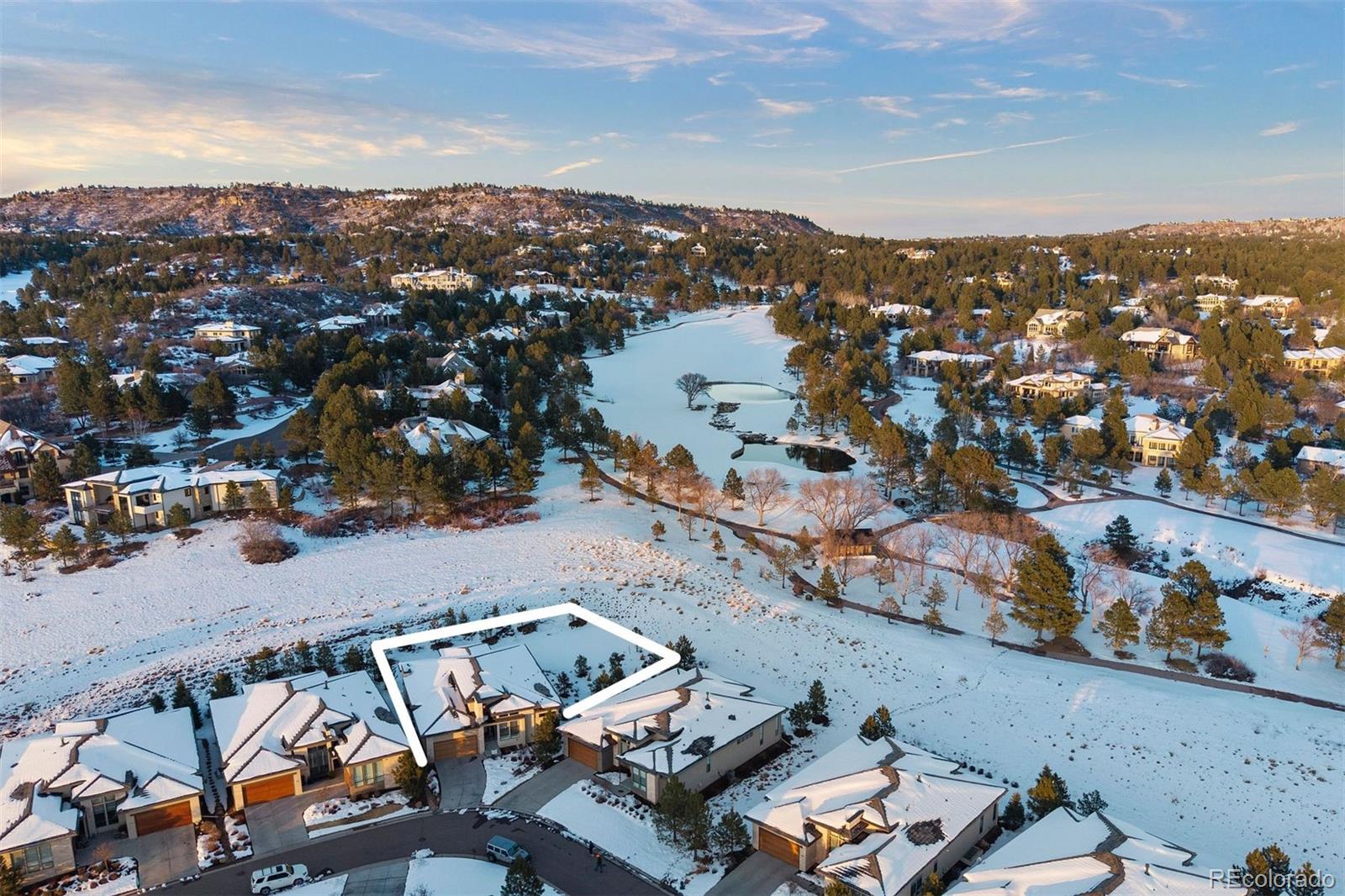 MLS Image #2 for 1173  lost elk circle,castle rock, Colorado